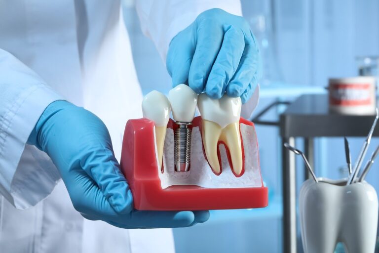 implant centres